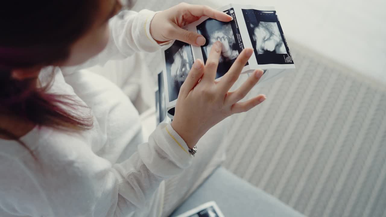 孕妇看3D超声扫描照片。视频素材