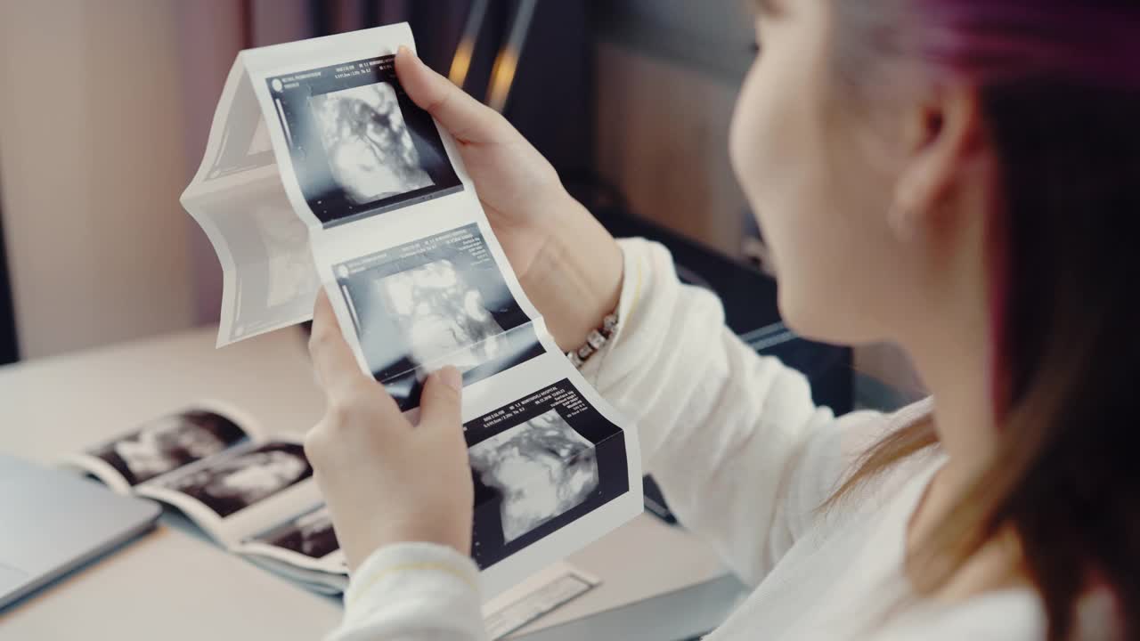 孕妇享受3D超声扫描照片。视频下载