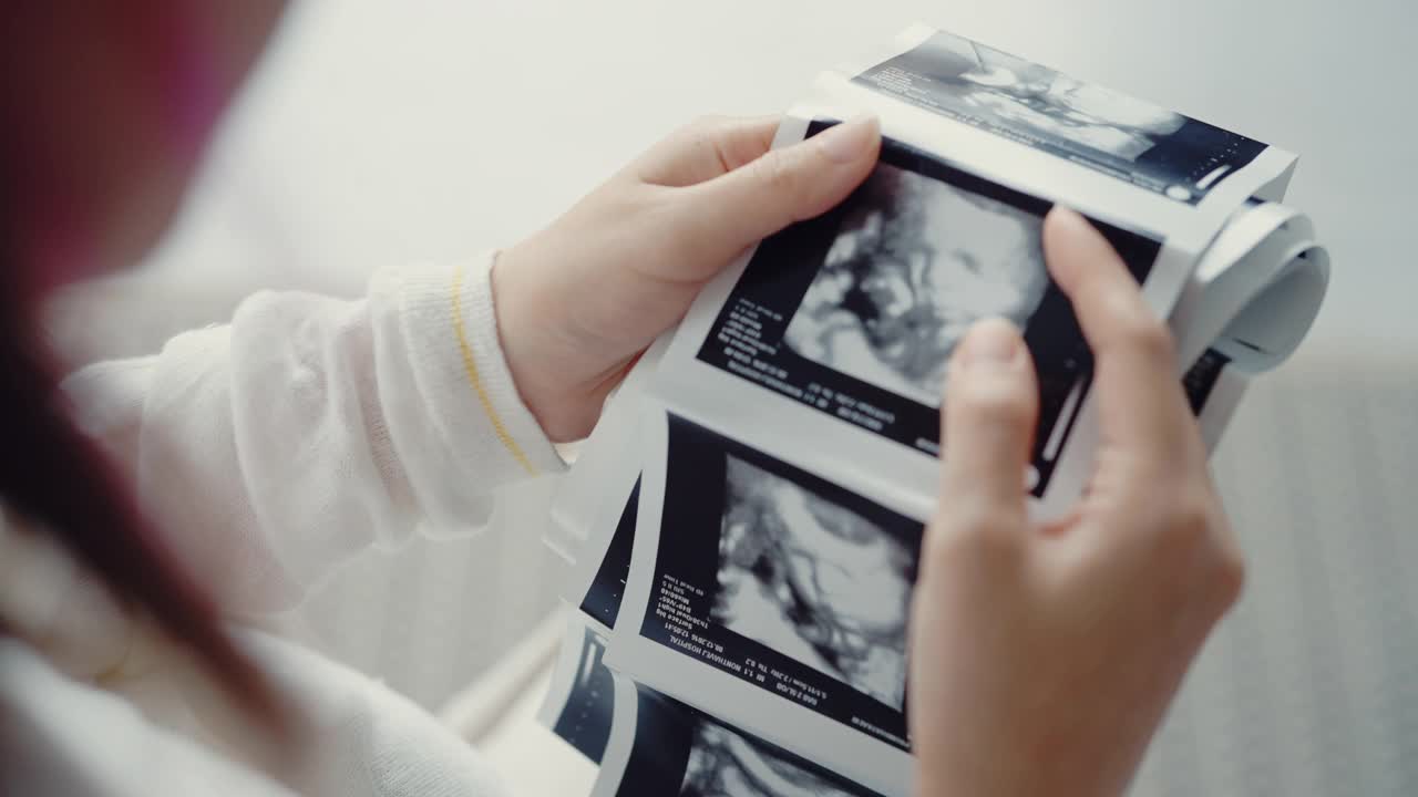 孕妇看3D超声扫描照片。视频素材