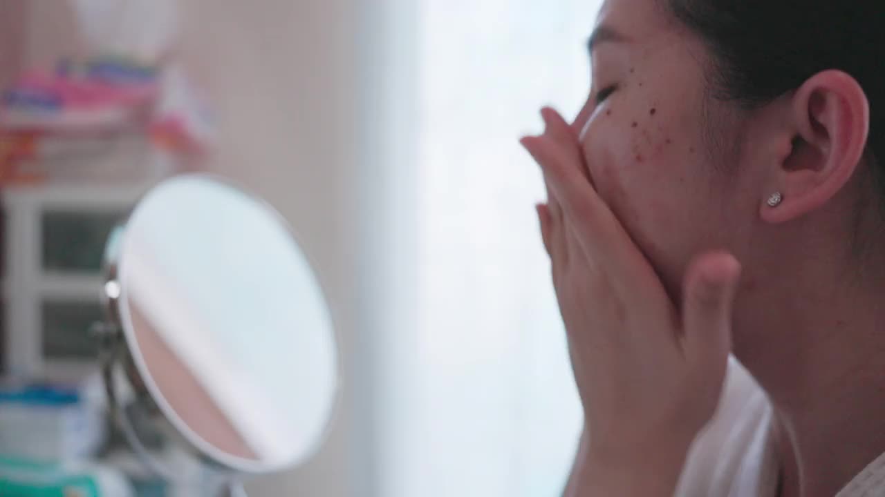 亚洲女性的化妆品和保健概念。一名皮肤有问题的少女正在使用护肤霜。皮肤护理的概念，痤疮是一种皮肤状况。视频素材