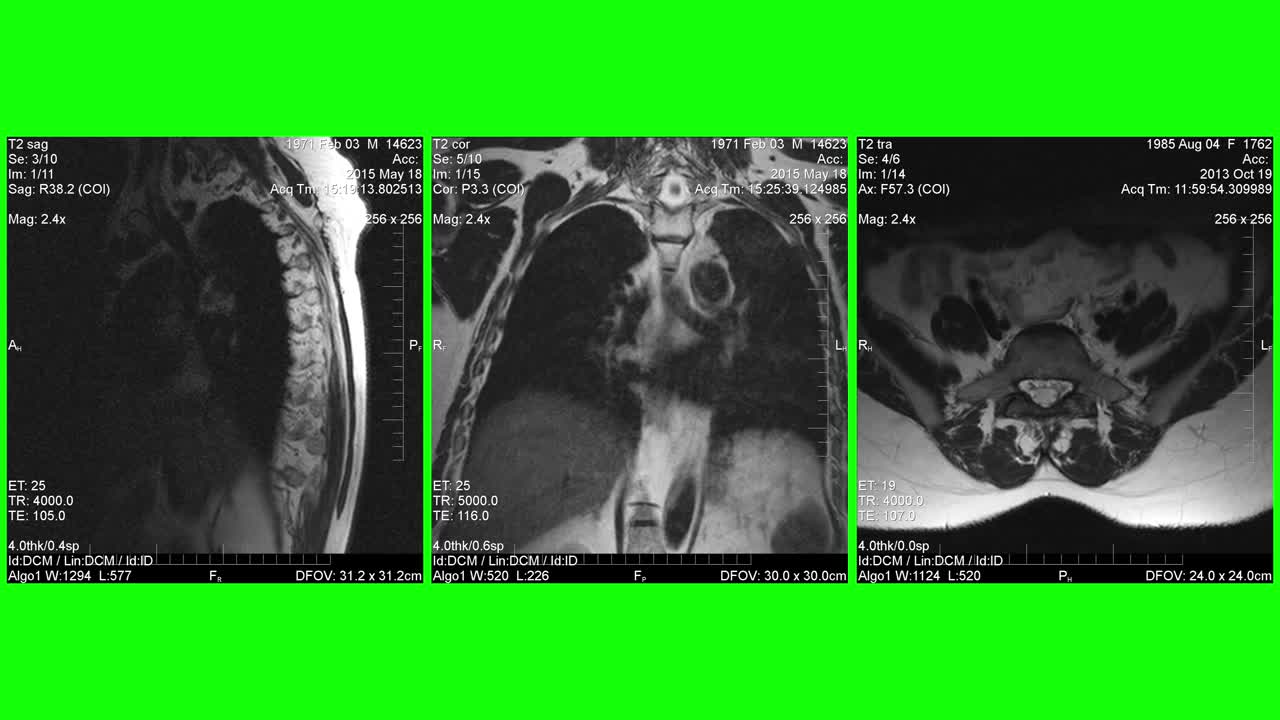 MRI，人体部位的磁共振图像视频素材