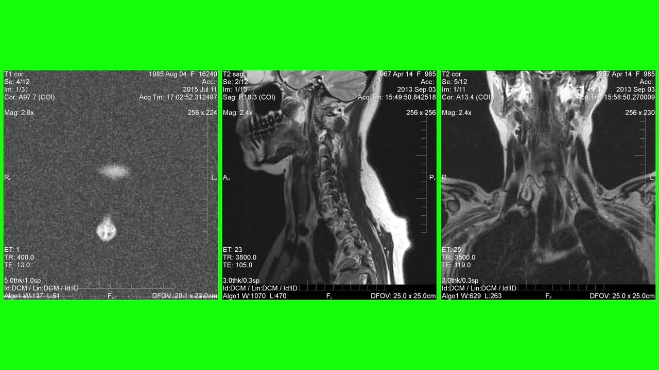 MRI，人体部位的磁共振图像视频素材