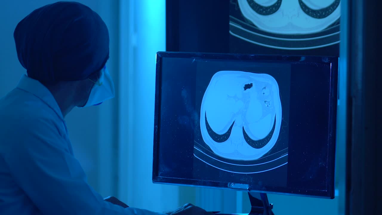 放射科门诊放射科医生检查患者胸部CT影像的高清视频视频素材