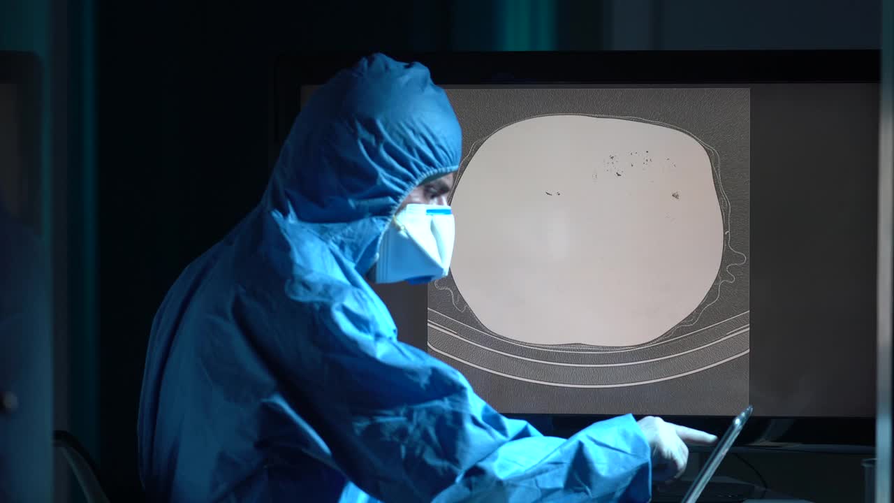 放射科门诊放射科医师检查患者胸部CT图像的4K视频视频素材