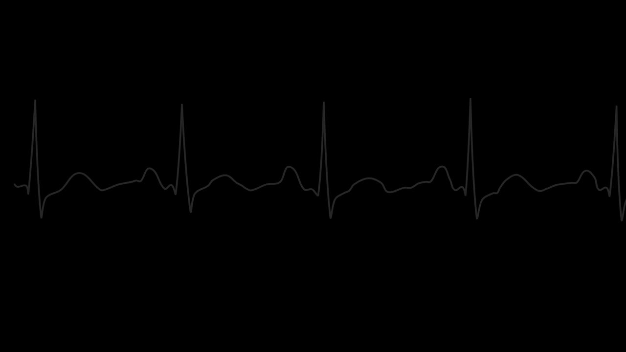 PNGα。心电图监视器。循环心电图。正常窦性心律。心率。2型视频素材