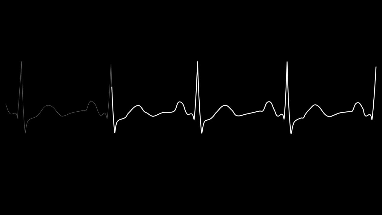 心电图循环.PNGα。正常窦性心律。心率。心跳线模板。心电图监测视频素材