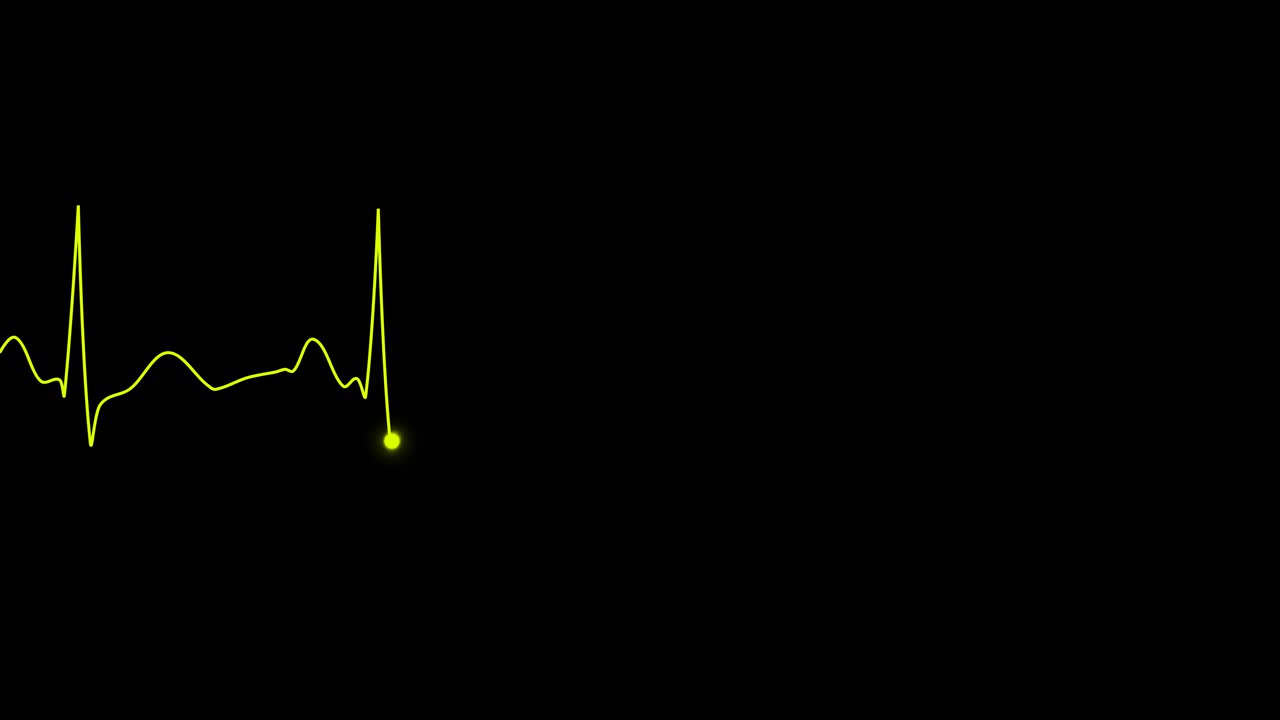 PNGα。心电图循环。正常窦性心律。心率。心跳线模板视频素材