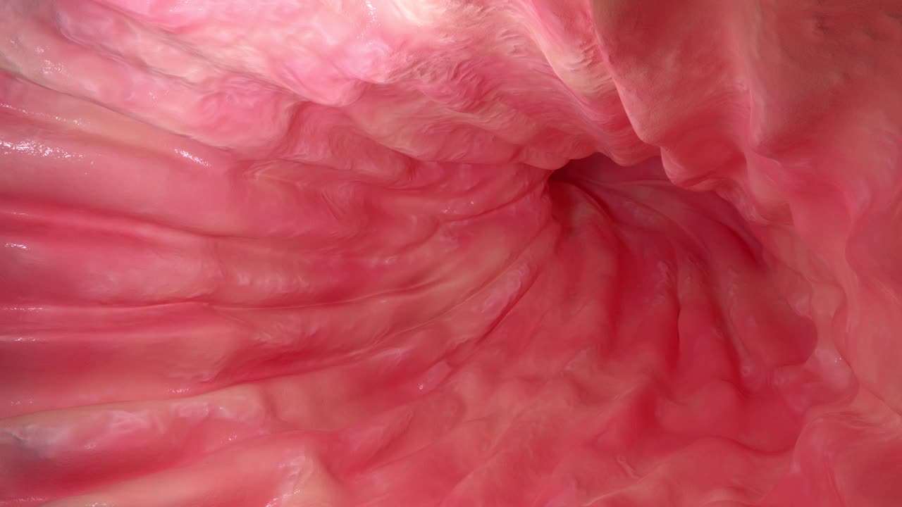胃癌视频素材