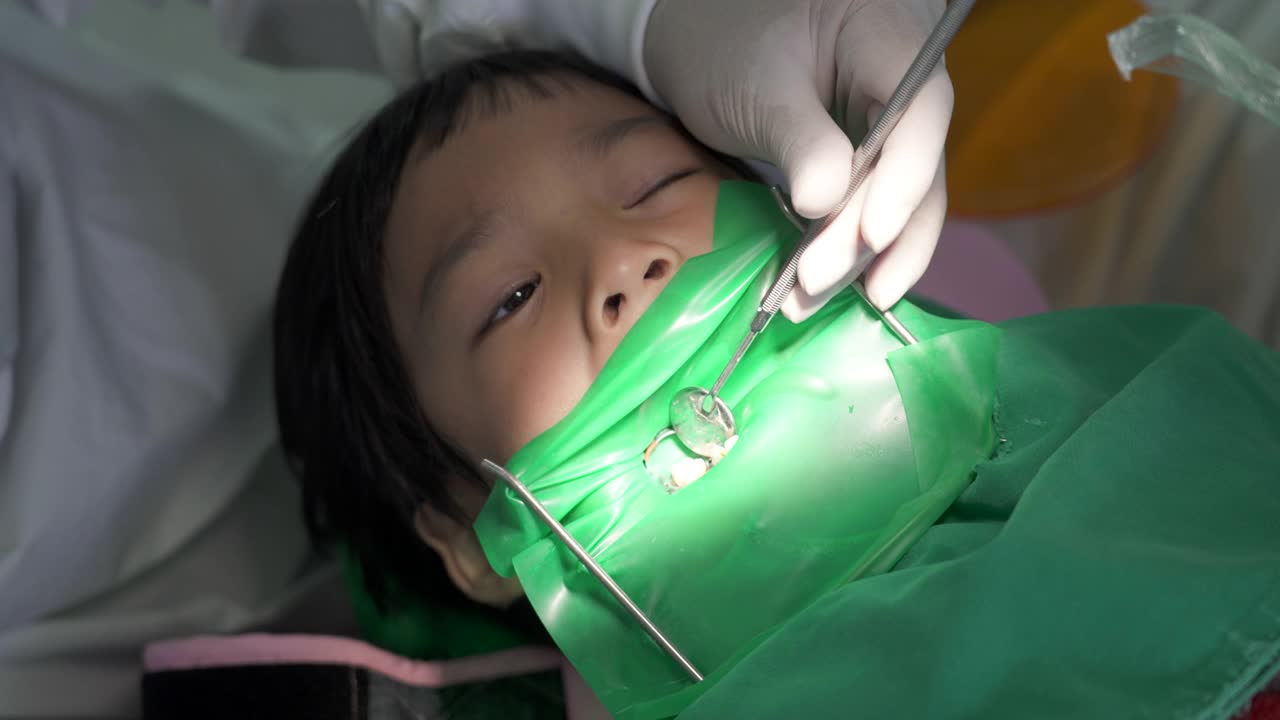 补牙，牙医用紫外线照射男孩的牙齿视频下载