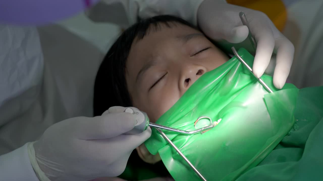 牙科医生正在给男孩补牙。视频下载