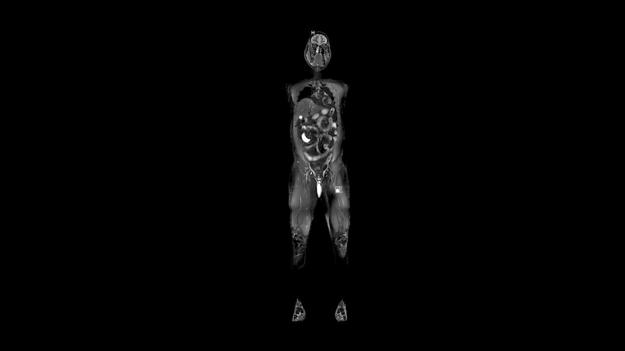 全身核磁共振成像。人类男性解剖三维动画生物科学视频下载