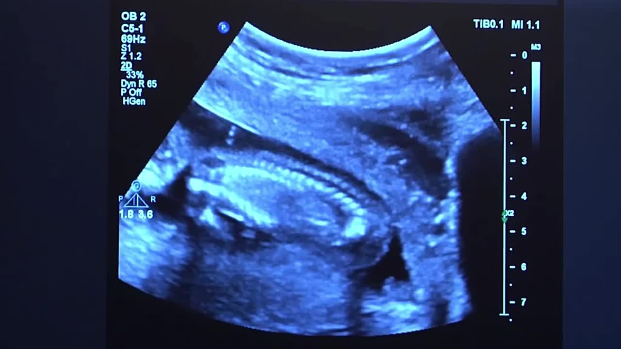 婴儿身体和脊椎的超声波。人类胚胎在超声波显示屏上轻微地移动着他的头。视频素材