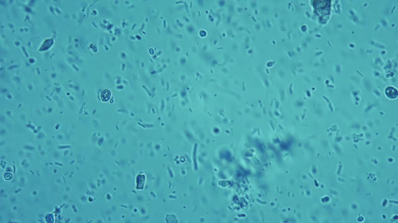 人的消化系统显微镜下的肠道生物多样性。最大的光学变焦。画面中可以看到酵母菌、链球菌、葡萄球菌等细菌，还有食物颗粒。布朗运动视频下载