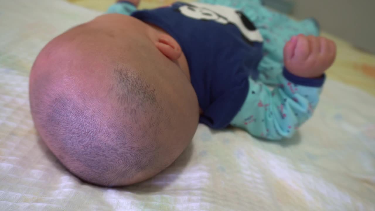 关闭脱发婴儿头躺视频下载