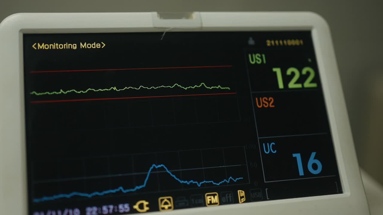 视频心血管内科ICU监护仪与住院患者生命体征视频下载