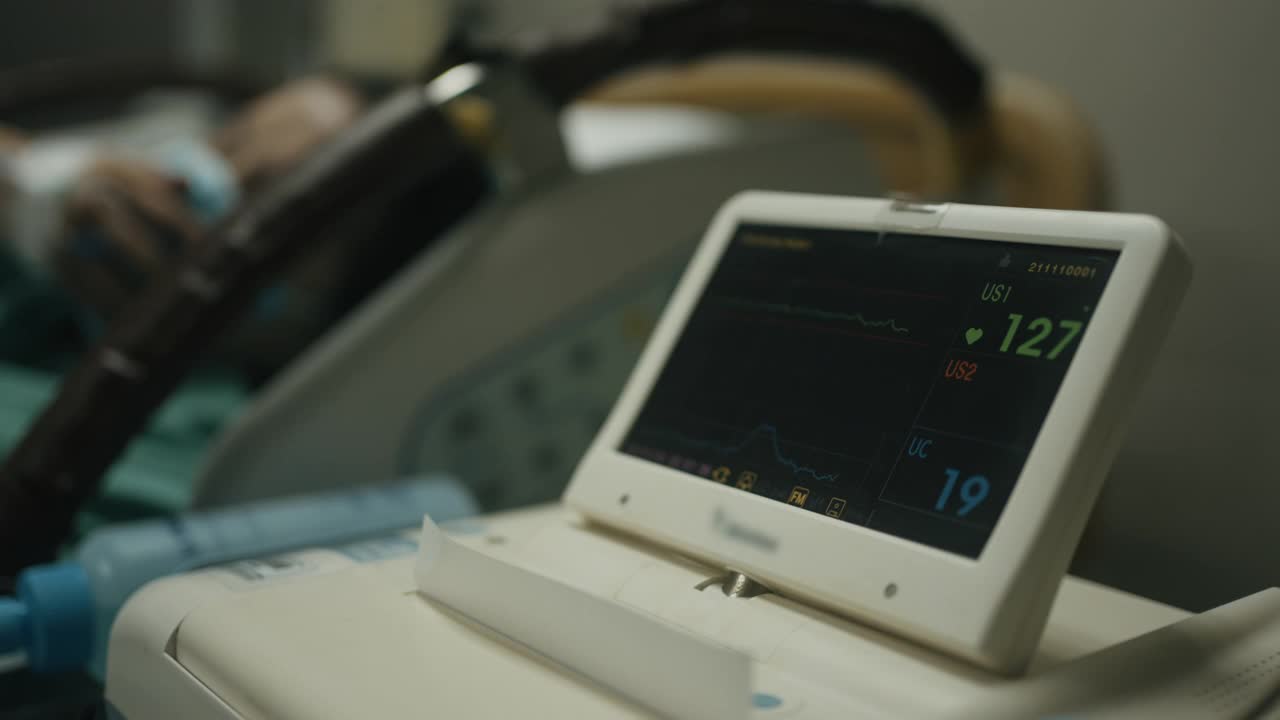 手术室内心脏监测器的特写。心电图显示孕妇心率背景视频下载