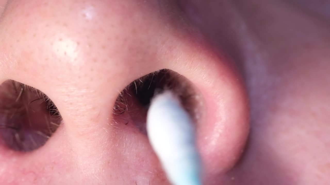 一名男子用卫生棉条在鼻子里测试自己是否感染了Covid - 19。视频素材