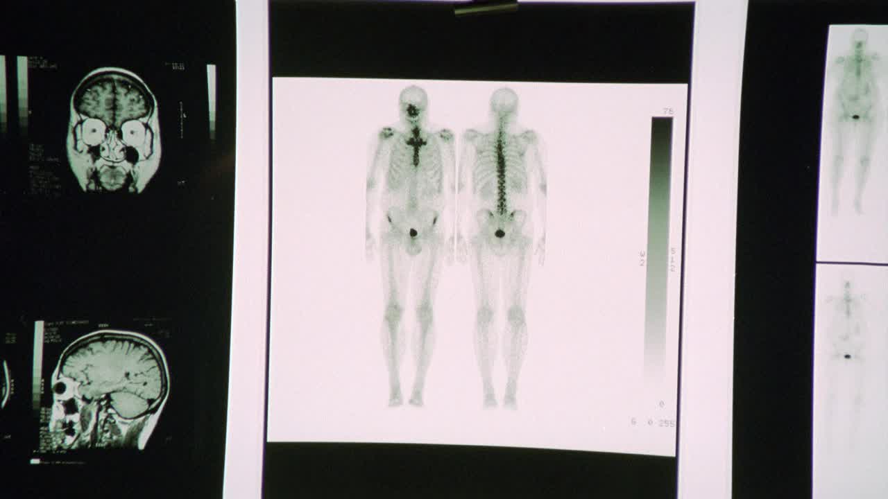 x光照片的近角度，包括骨骼和胸腔的图片。可能是医务室或急诊室视频下载