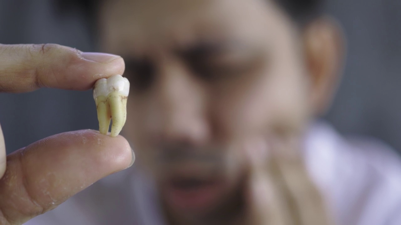 近距离观察一个亚洲男人，手里拿着臼齿，牙痛视频下载