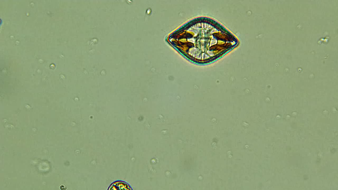 硅藻微生物显微镜观察视频下载