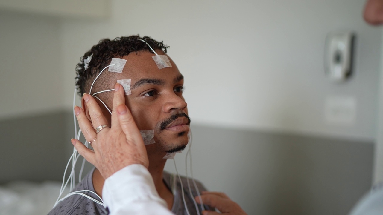 医生将电极放在病人头上进行医学检查视频素材