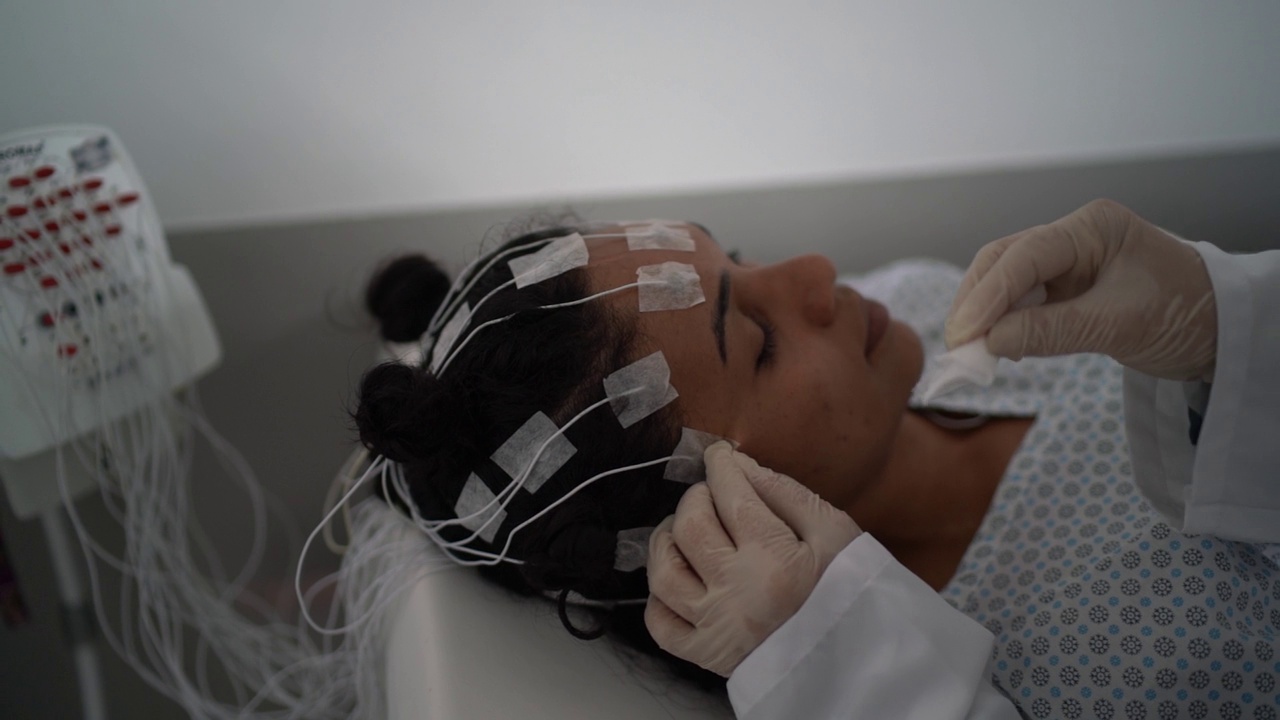 医生在多导睡眠描记(睡眠研究)后取出病人头部电极视频下载
