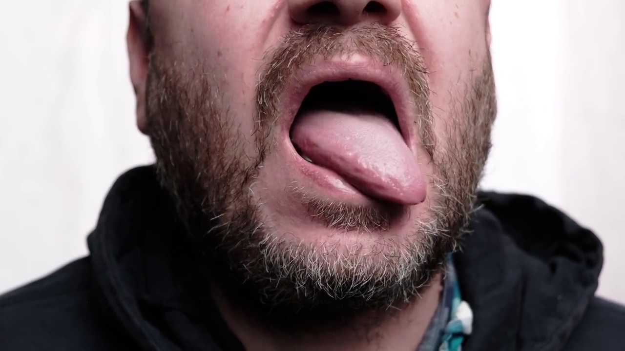 那人伸出舌头。检查舌头上的菌斑。胡子拉碴的男人。视频下载