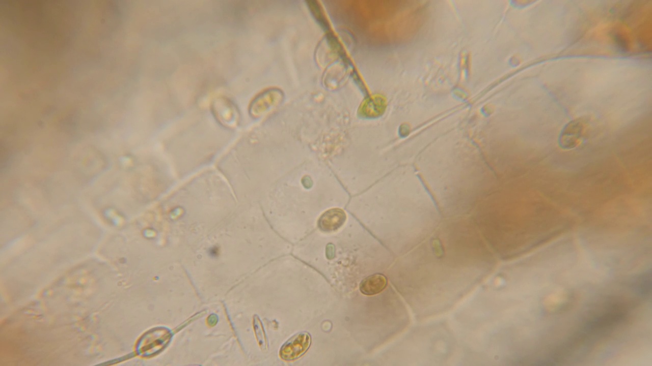 显微镜下的叶绿体死亡植物。细胞分裂。死亡植物的细胞结构。病毒感染。显微镜下的微生物微生物细菌。转基因生物的DNA。视频素材