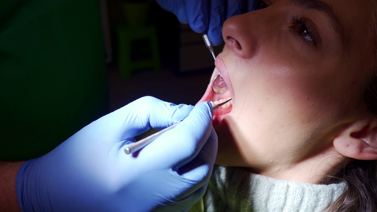 牙医检查女病人的b卷视频下载