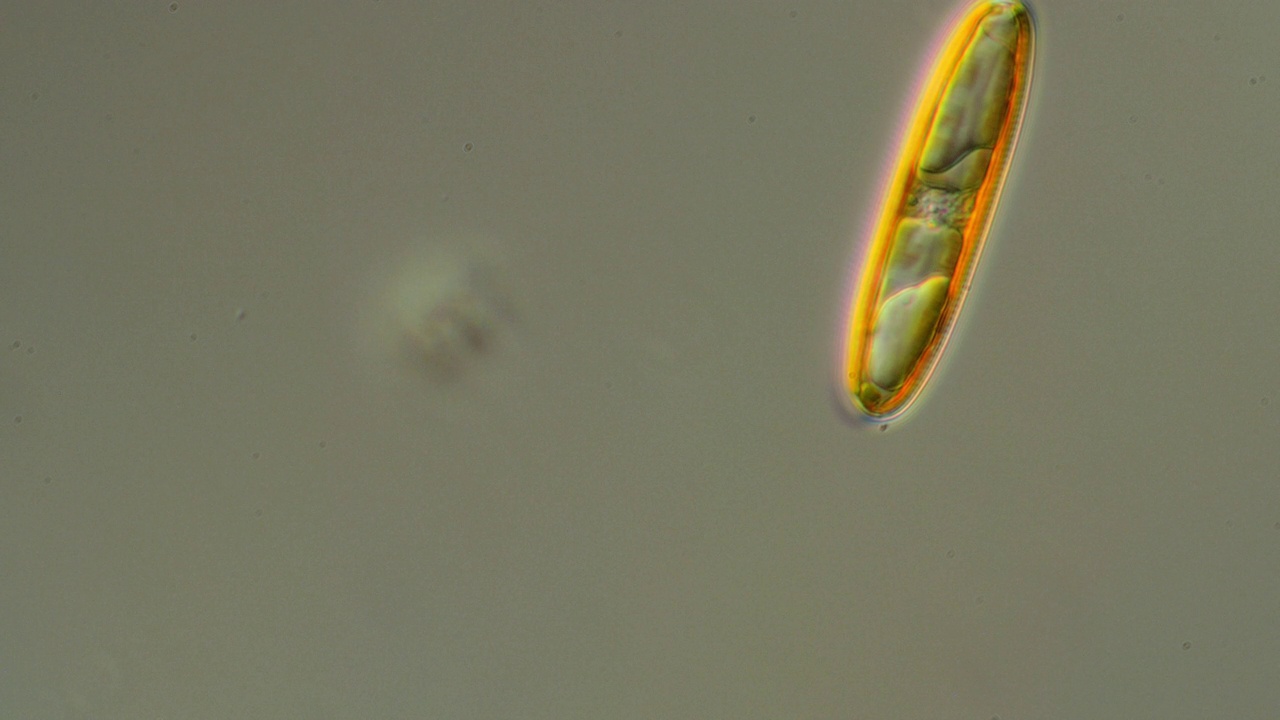 显微镜的硅藻视频下载