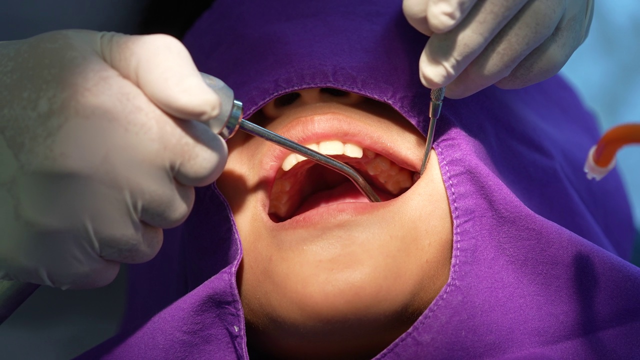 牙科卫生员和牙医诊所专业的刷牙和清洁牙齿。牙齿和口腔健康和卫生是现代人类生活的重要组成部分，牙科帮助。视频下载