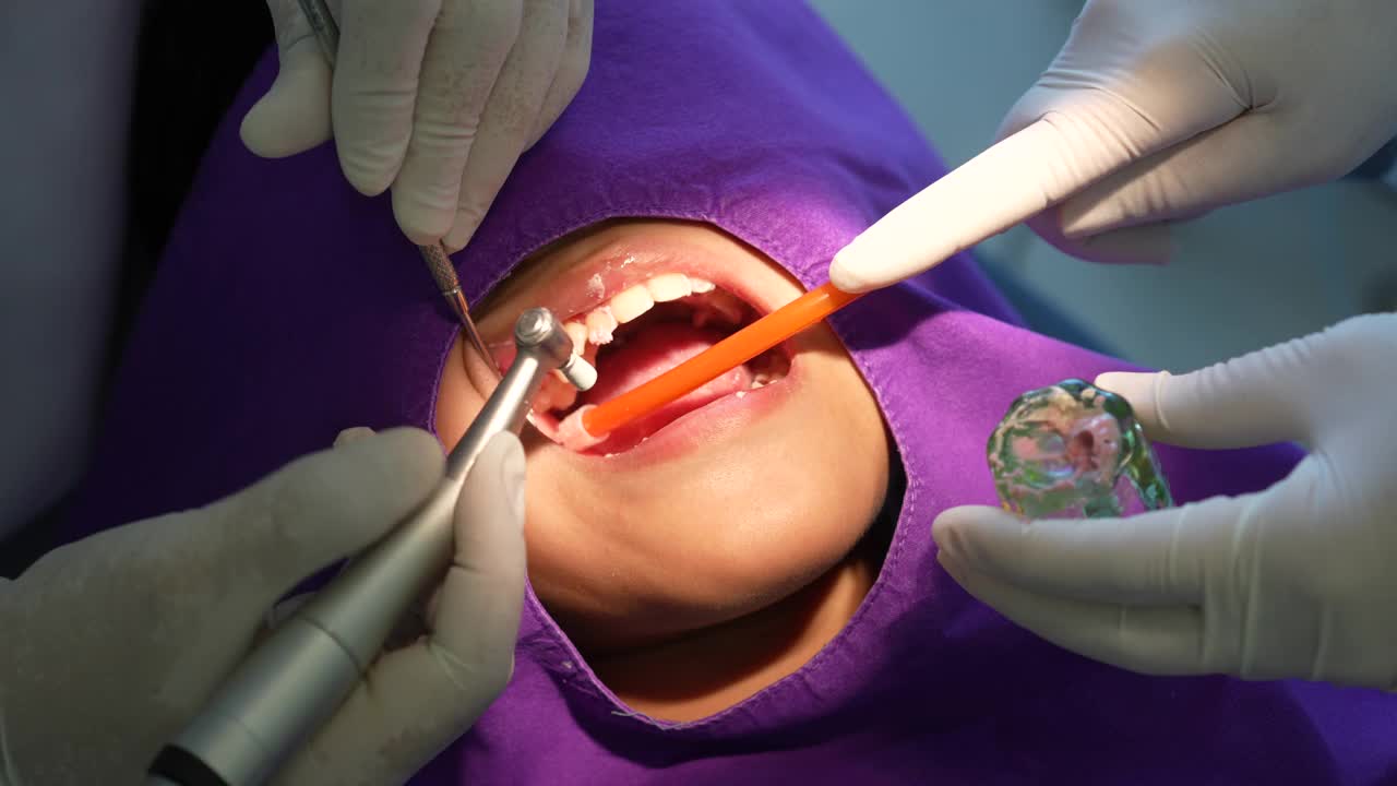 牙科卫生员和牙医诊所专业的刷牙和清洁牙齿。牙齿和口腔健康和卫生是现代人类生活的重要组成部分，牙科帮助。视频下载
