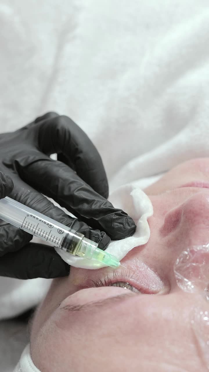 美容师给女人的脸上注射一种能使皮肤年轻化的药物。视频下载
