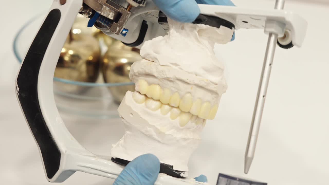 近距离的牙医或牙科种植专家持有现实的人类颌骨种植布局视频下载