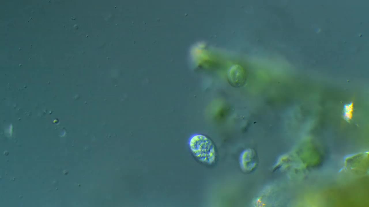 显微镜的纤毛虫视频下载