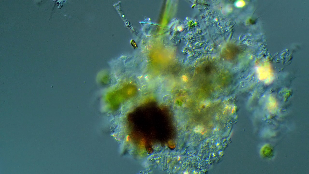 显微镜的纤毛虫视频下载
