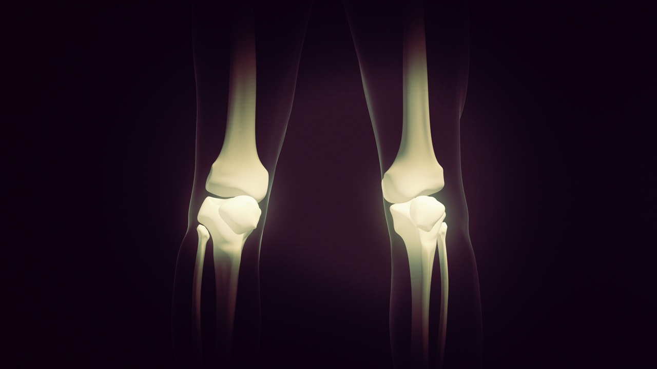 膝关节疼痛的医学概念视频下载