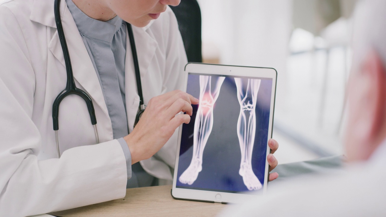 一名医生使用数码平板电脑向病人展示x光扫描的4k视频片段视频素材