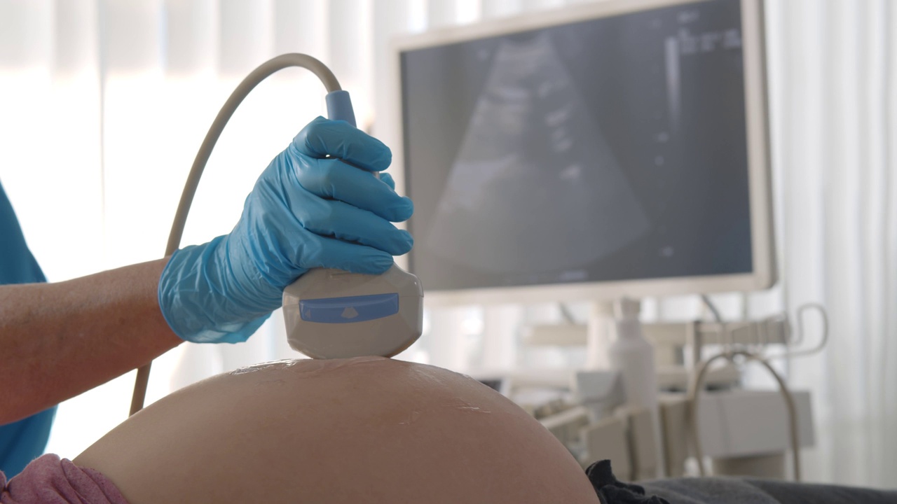 现代临床医生对年轻孕妇腹部进行超声检查视频素材