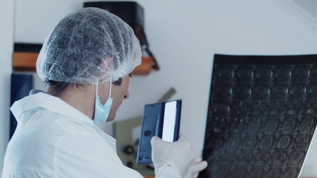 一名男性外科医生通过脑瘤的x射线图像研究诊断结果，然后用智能手机进行扫描。视频素材