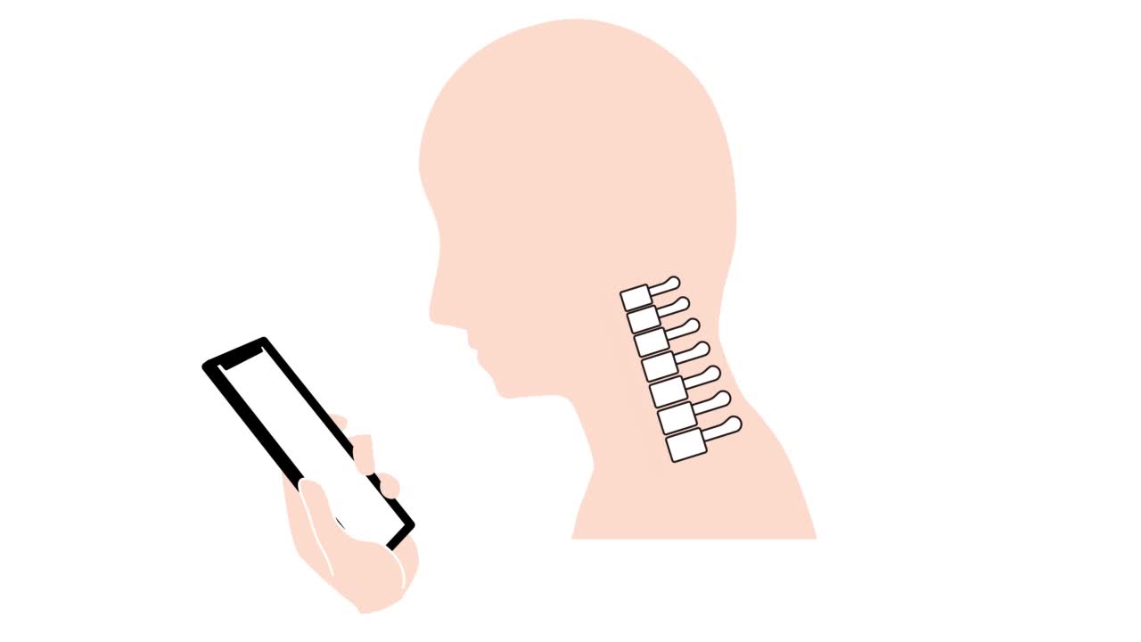 这是一段动画视频，展示了直颈(智能手机颈)是如何引起脖子和肩膀疼痛的。视频下载