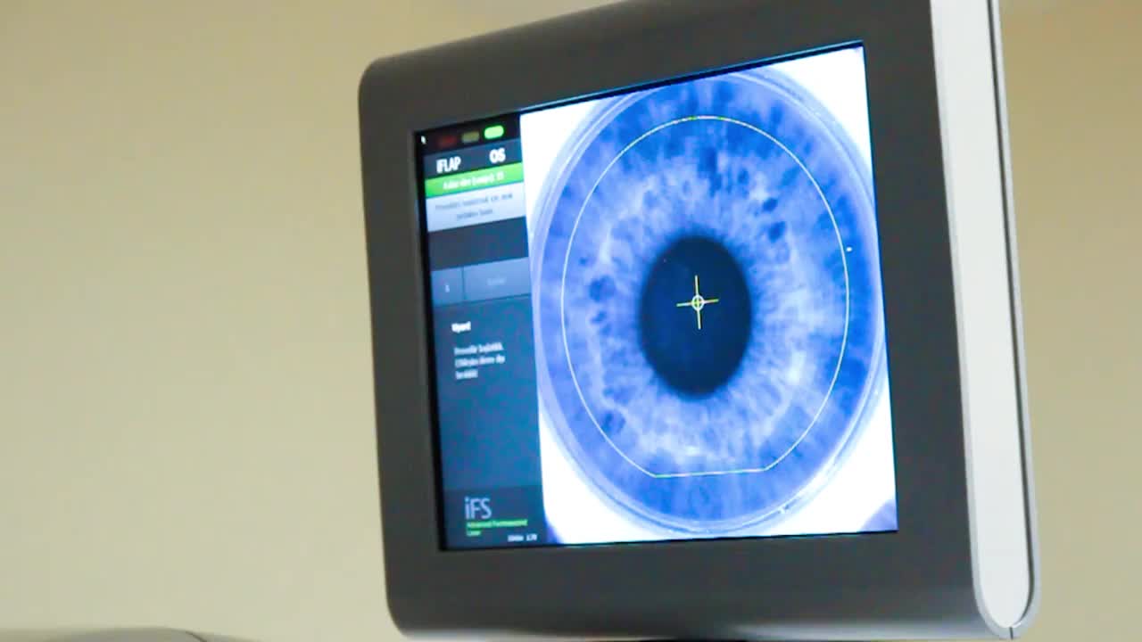 激光眼科手术中的激光手术，从监视器近视眼拍摄视频下载