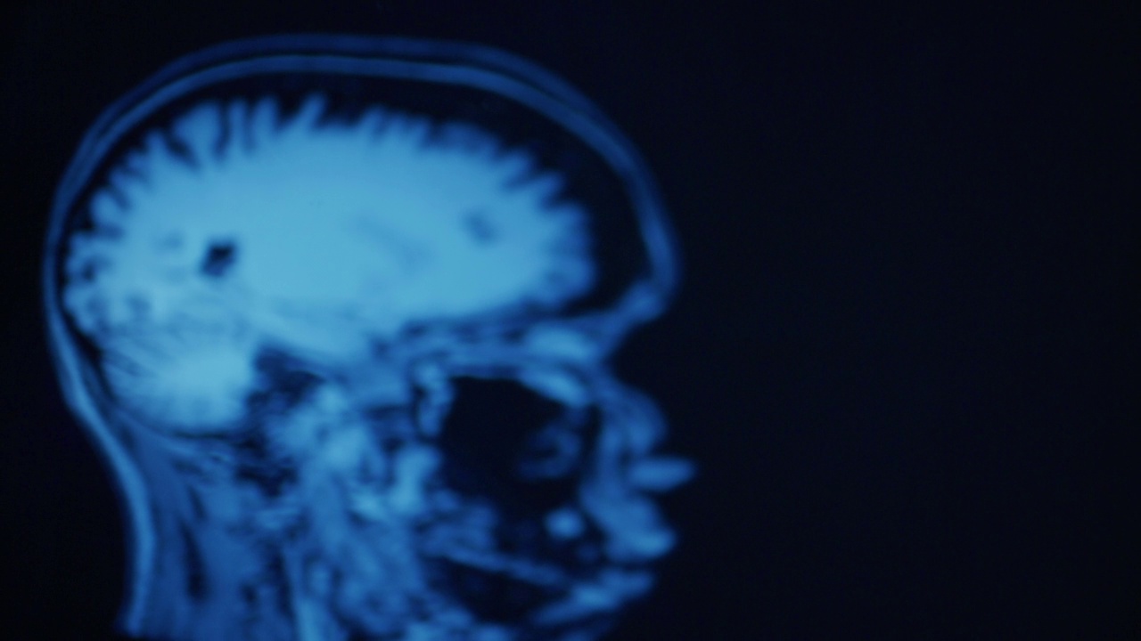 动画MRI神经脑部扫描。视频下载