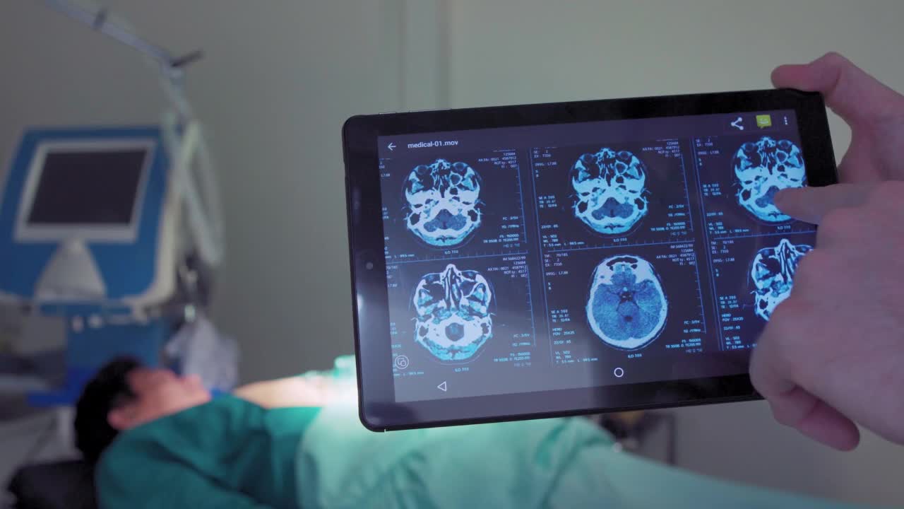 专业外科医生在看数字平板电脑上的大脑扫描显示视频素材