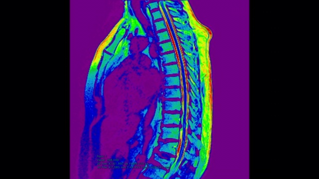 腰背部MR扫描彩色。视频下载