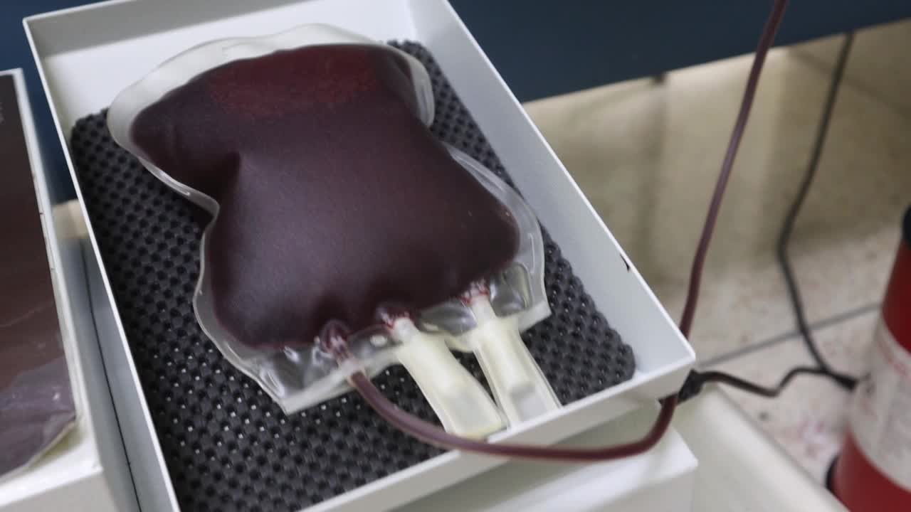 献血者的血袋被放置在献血的摇血机上视频素材