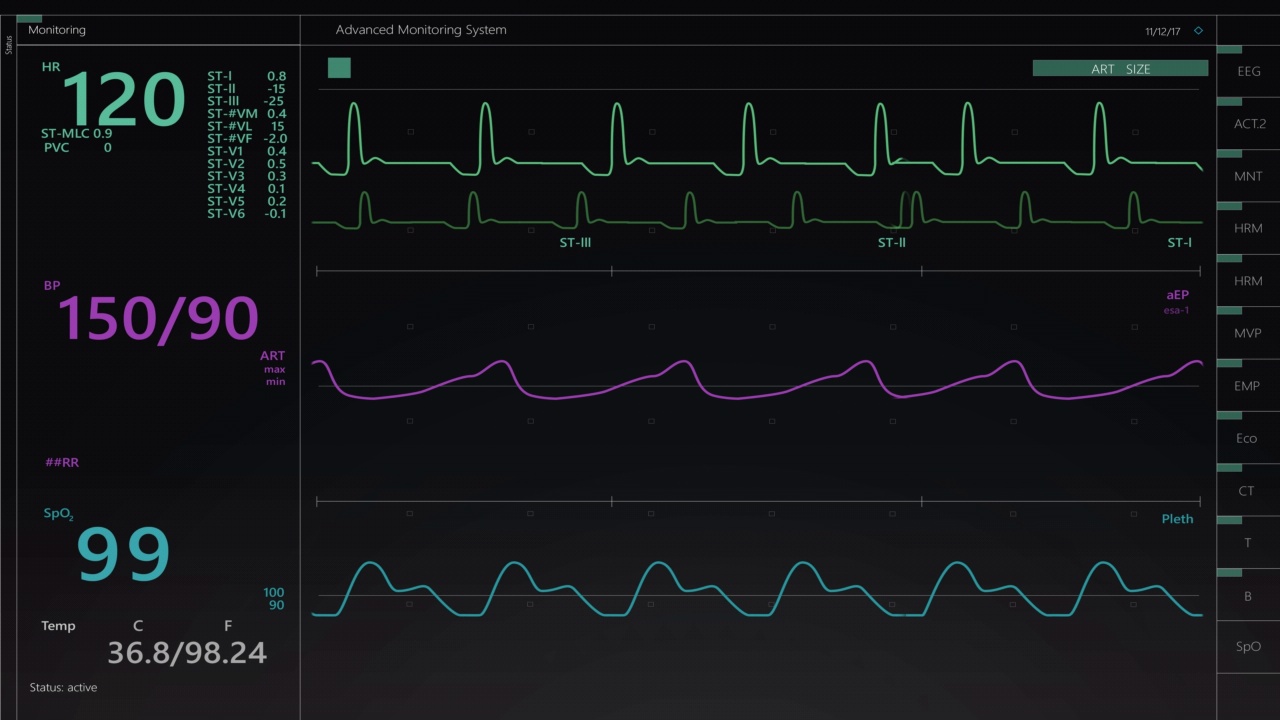 生命体征监测与心率和其他医疗参数的动画模型。重症监护室计算机显示器和笔记本电脑屏幕的病人生命体征和心电图模板。视频下载