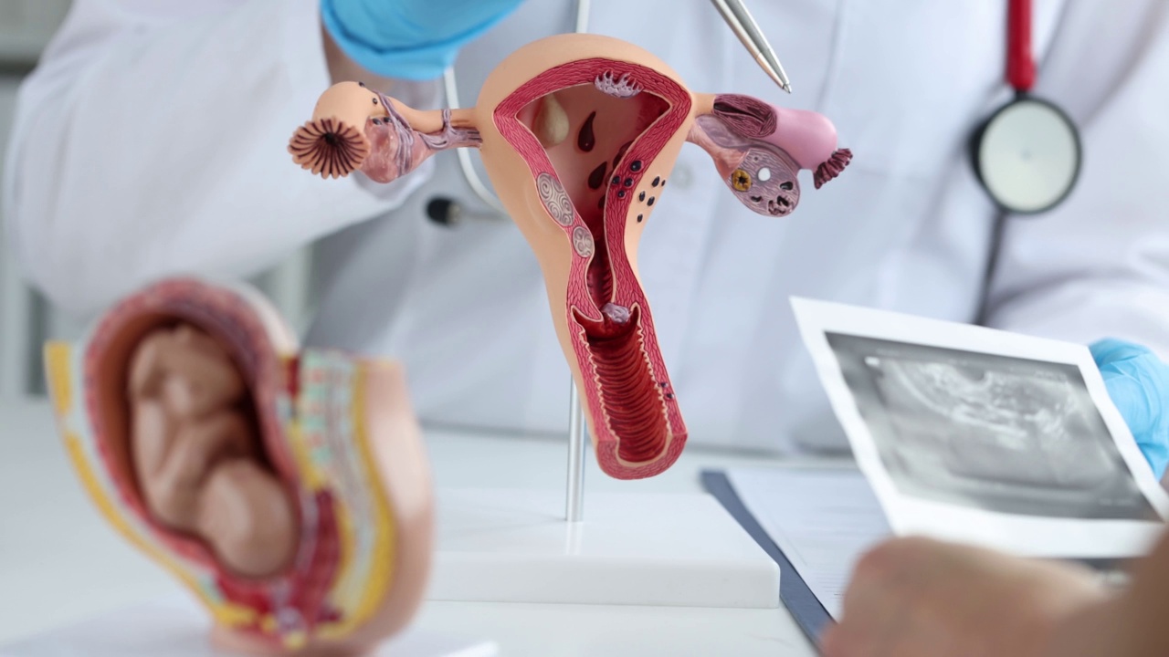 妇科医生向患者展示子宫解剖及卵巢超声检查视频下载