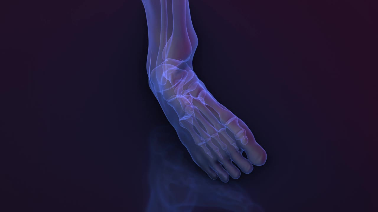 脚踝扭伤-骨骼x光片。视频素材