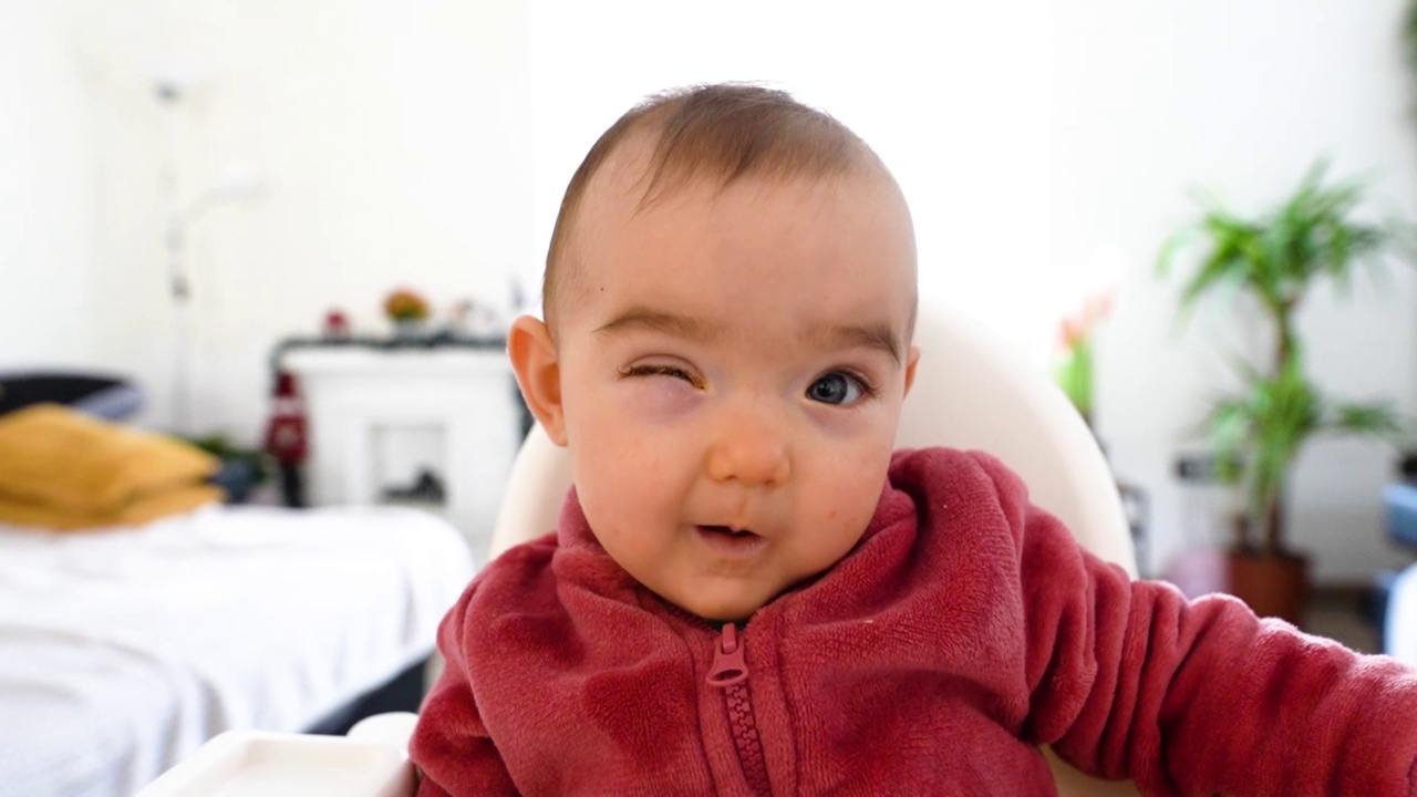 女婴眼部感染在家视频素材